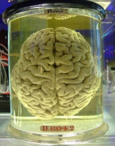 Human-brain 257.jpg